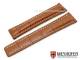 Uhrenarmband \