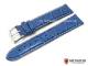 Uhrenarmband \