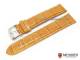 Uhrenarmband \
