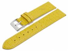 Meyhofer EASY-CLICK Uhrenarmband Santos 16mm gelb Leder Kroko-Pr&auml;gung abgen&auml;ht (Schlie&szlig;enansto&szlig; 14 mm)