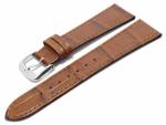 Uhrenarmband 